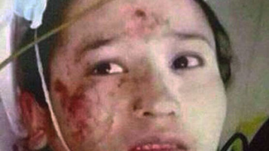 [사진] 쿤밍 테러 10대 소녀 용의자