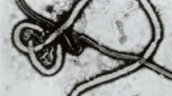 에볼라는 감염 동물·환자 접촉으로, 홍역은 호흡기 통해 옮겨