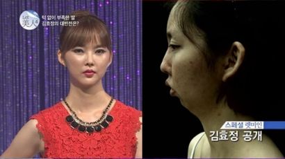 ‘렛미인’ 김효정, 59일의 변화에 스튜디오는 눈물바다… 왜?