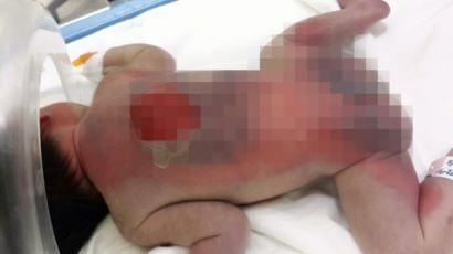 안동 산부인과 신생아 2명 중화상… 사진보니 ‘끔찍’ 어쩌다 이런 일이?