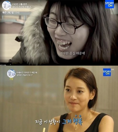 '렛미인 박동희' 적응 안되는 과거 사진, 