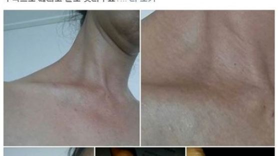 김부선 폭행 혐의 부인, 멍 투성이 사진 공개…'진흙탕 싸움' 시작되나?
