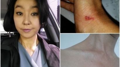 김부선 폭행 혐의 부인, "나도 피해자" 상처 사진 보니