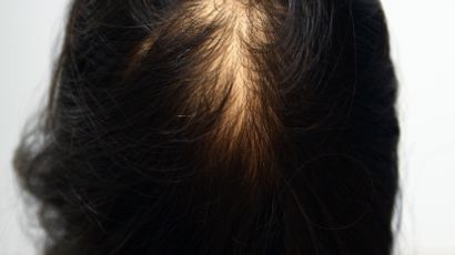 환절기 탈모 예방법, 여자도 위험…머리카락 빗을 때 '이런 현상' 발생하면?