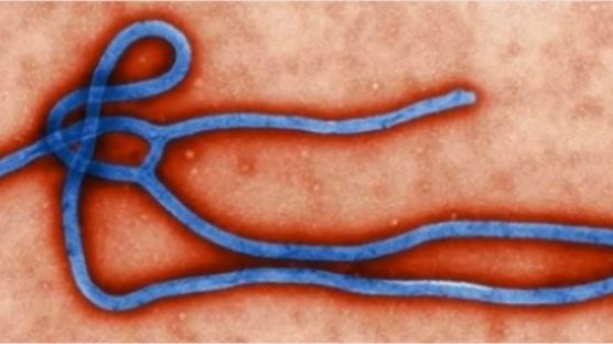 에볼라에 관한 8가지 궁금증 "에볼라, 누구냐 넌" 