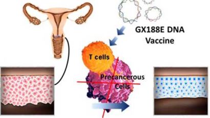 자궁경부전암 유전자치료백신 국내 연구진이 개발