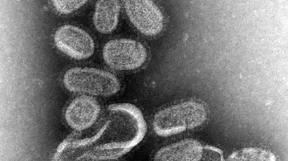 '인플루엔자' 정의 "독감이라고도 불려"…두통·발열·오한·근육통 가져온다
