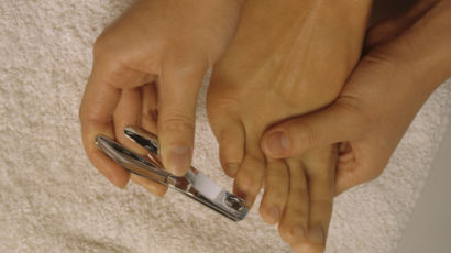 내향성 발톱 치료법, 주로 엄지발톱에 생겨…'일자 발톱의 중요성'