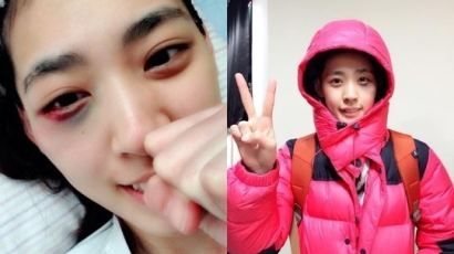 미녀파이터 박지혜, 데뷔전 일본선수에 TKO 승…붉게 멍든 눈에도 '활짝'