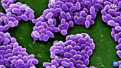 탄저균 배달사고 "살아있는 탄저균 샘플이 발견돼" 감염자는?