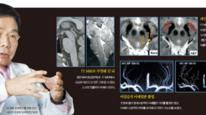 [건강한 당신] 서유헌 가천대 뇌과학연구원장 "초정밀 MRI로 뇌질환 규명, 임상연구 … 치매 정복 머잖았다"