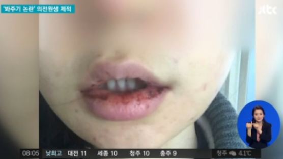 조선대 의전원생 벌금 1200만원 받은 이유가 여자친구를…