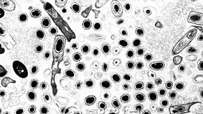 정부 "미군, 한국서 16차례 탄저균 실험"…흑사병을 일으키는 페스트균도