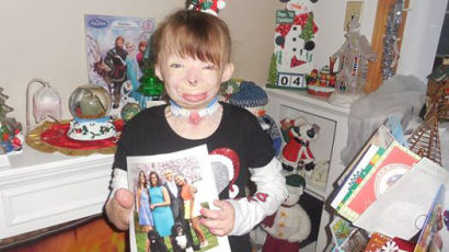 백악관, 비욘세에게 크리스마스 카드 받은 이 사람은…화재 생존자 8살 소녀