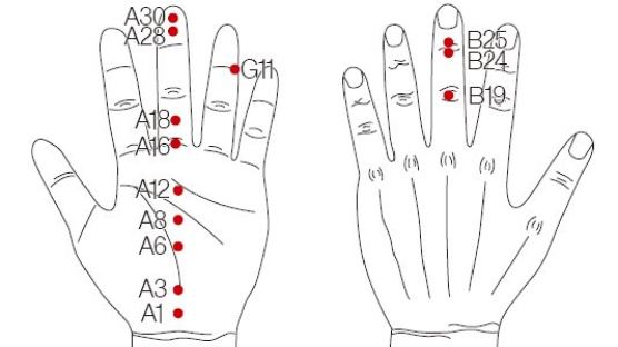 [유태우의 서금요법]손에 땀 많을 땐 B19·24, A1~30, G11 자극