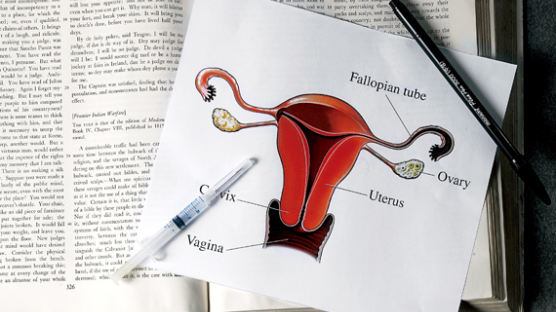 올해부터 만 20세 이상 여성에 자궁경부암 검진 무료