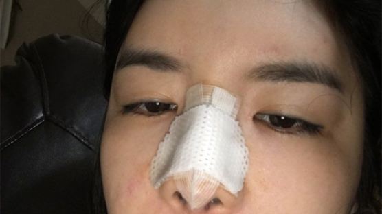 에이미 "코뼈 부러졌다" 주장···경찰 조서·상처 공개