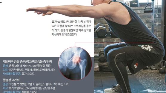 [건강한 당신] 고강도 운동 탓 엉덩관절 손상…무릎·허리 통증도 일으킵니다