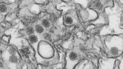 [속보] 지카바이러스 두 번째 감염자 동행 형도 '양성' 판정