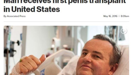 미국 암 환자 성기 이식 수술 성공