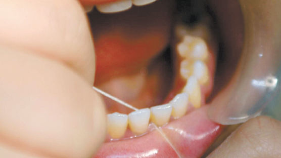 치아 건강 지켜준다던 치실 효과없다