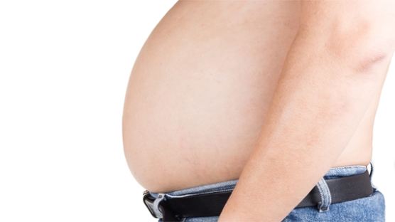 25살 이전 비만이었다면 성인기 암 발생 위험성 높다