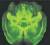 광학현미경을 이용해 만든 투명 뇌지도. 신경세포 하나하나가 보인다.