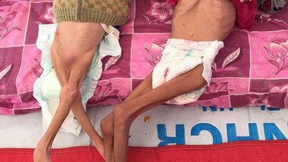 IS 공격에…피골 상접한 기아들 사진