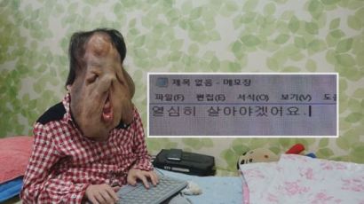'신경섬유종' 심현희씨 후원금 10억의 사용 계획