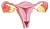 자궁내막은 매달 한 번씩 두터워졌다가 두 층으로 분리된다.