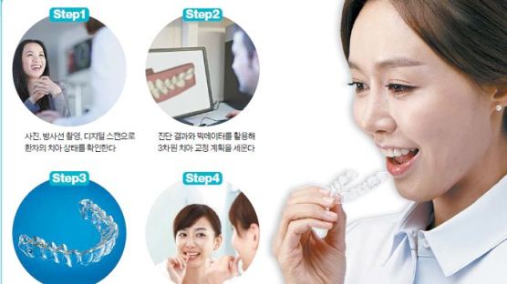 [건강한 가족] 치아 교정 장치, 3D 프린팅·빅데이터 활용하니 정확도↑
