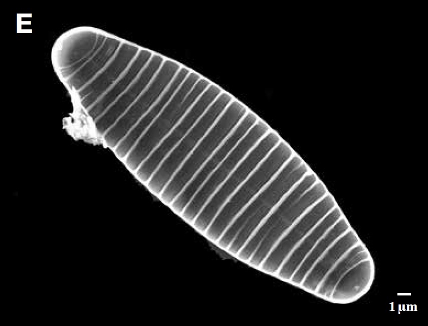낙동강에서 채집된 규조류(돌말) 다이아토마(Diatoma vulgae)의 전자현미경 사진. [국립낙동강생물자원관]