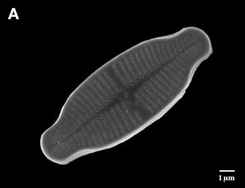 낙동강에서 채집된 규조류(돌말) 아크난티디디움(Achnanthidium exiguum)의 전자현미경 사진. [국립낙동강생물자원관]