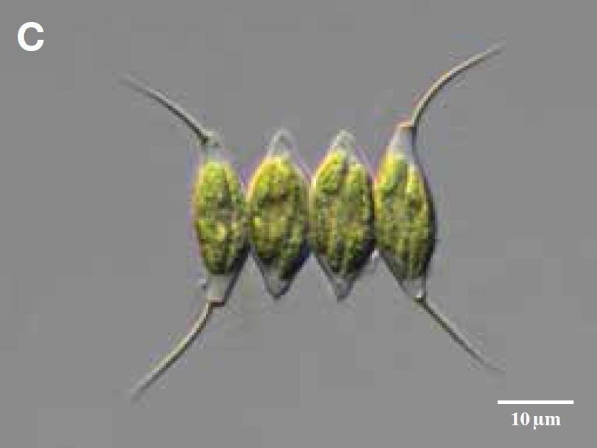 낙동강에서 채집한 녹조류 데스모데스무스(Desmodesmus opoiliensis)의 광학현미경 사진.[국립낙동강생물자원관]