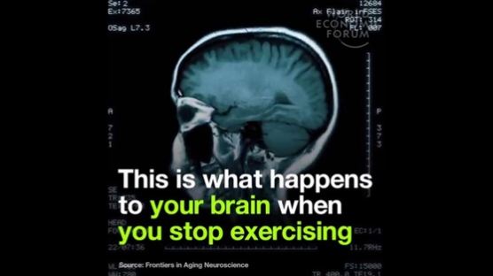운동을 하지 않을 때 일어날 수 있는 뇌의 변화