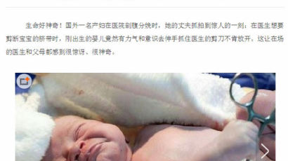 “내 건 내가 알아서” 탯줄 가위 부여잡은 신생아 사진 중국서 화제 