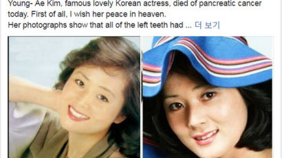  배우 김영애씨가 잘못된 치과치료로 암에?…치과의사 페이스북 논란