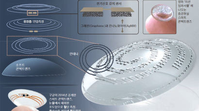 ‘닥터’ 콘택트렌즈 … 착용하면 당뇨병·녹내장도 진단