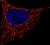 미토콘드리아(붉은색)는 세포의 보일러로, 과식으로 고장나면 분해돼야 한다. 파란색으로 나타낸것은 세포핵이다.