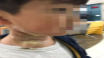 "대구 어린이 폭죽 테러사건 부모입니다"…온라인서 화제