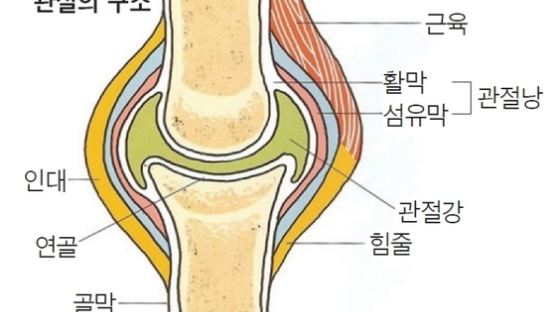 [김선우 원장의 ‘행복한 내 몸’ 퇴행성 관절염]몸무게 1kg 늘면 무릎 하중 4~5배 증가 