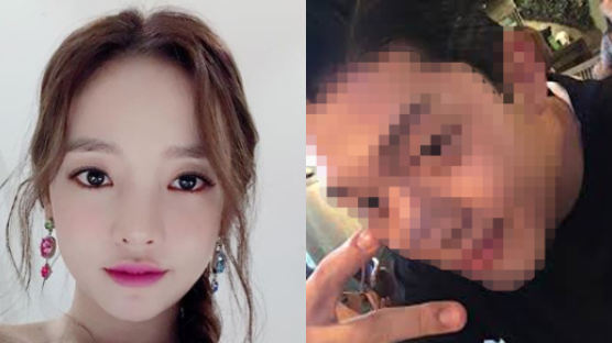 GOO HARA & Her Boyfriend's Assault Incident Rushes into Truth Game…Both Sides' Claim Summarized 