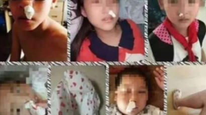코피 흘리는 학생들…중국 초등학교에서 일어난 코피 괴담