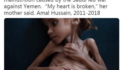 ‘예멘 고통의 상징’ 7세 소녀 결국 하늘로