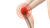 연골 세포는 자가증식 능력이 매우 부족해 거의 재생되지 않는다고 알려져 있다. 퇴행성관절염 증상은 무릎 관절에 관절액이 차 무릎에 부종을 일으키고 통증이 심해져 보행에 지장을 준다. [사진 pixabay]