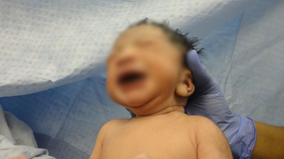 "아이 죽어가" 美식물인간 여성 출산 당시 녹취 공개