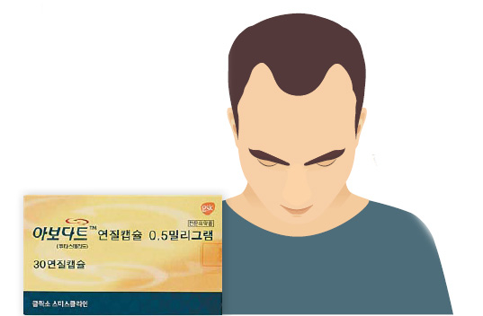 [건강한 가족] 한국 남성에게 많은 'M자 탈모' 개선에 효과적