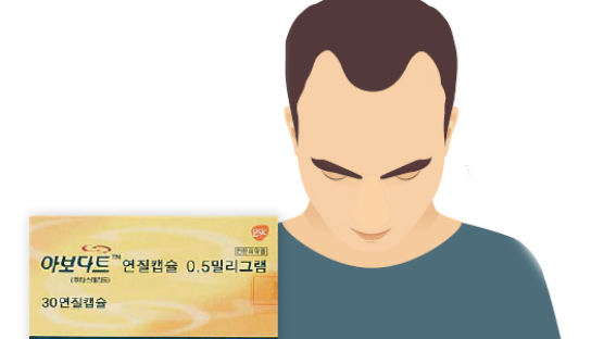 [건강한 가족] 한국 남성에게 많은 'M자 탈모' 개선에 효과적