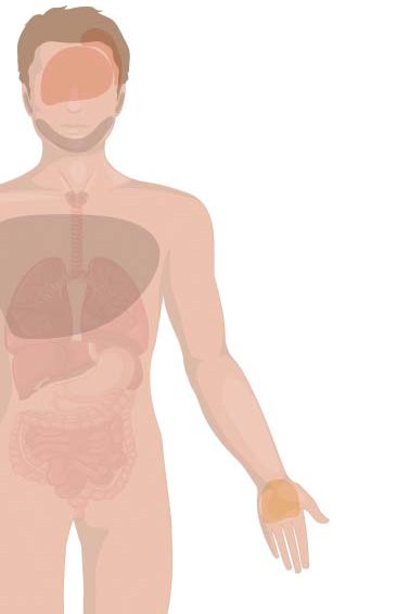 [건강한 가족] 손발 말랑한 혹은 지켜보고, 피부 딱딱한 혹은 빨리 치료받고 | 중앙일보