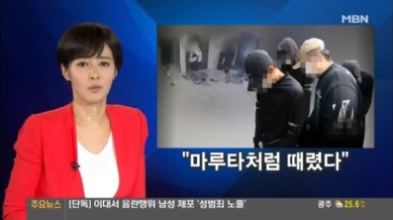 생방송 중 식은땀 김주하 "기절하듯 쓰러져···이게 뭔 민폐"